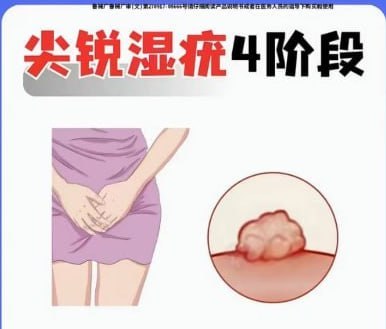 投稿配图